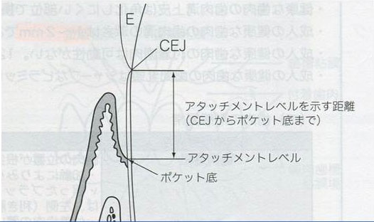 歯肉が歯に付着する高さ