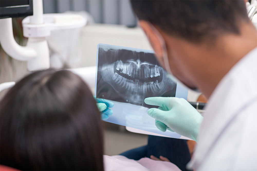 レントゲンを使って患者に歯の説明をしている歯医者のイメージ写真