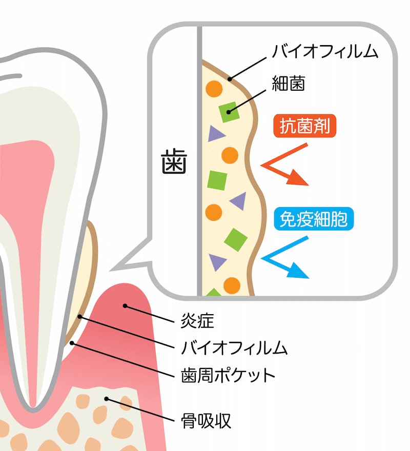 バイオフィルム　歯