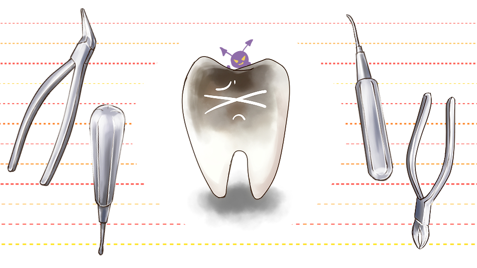 虫歯の歯と抜歯の道具（ペンチやトンカチなど）のイメージ画像