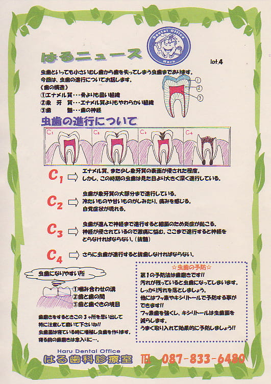 はるニュースVol.4「むし歯の進行について」
