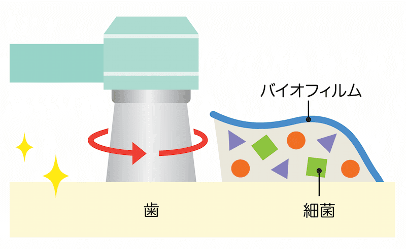 バイオフィルム　除去　歯