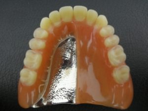 即時義歯