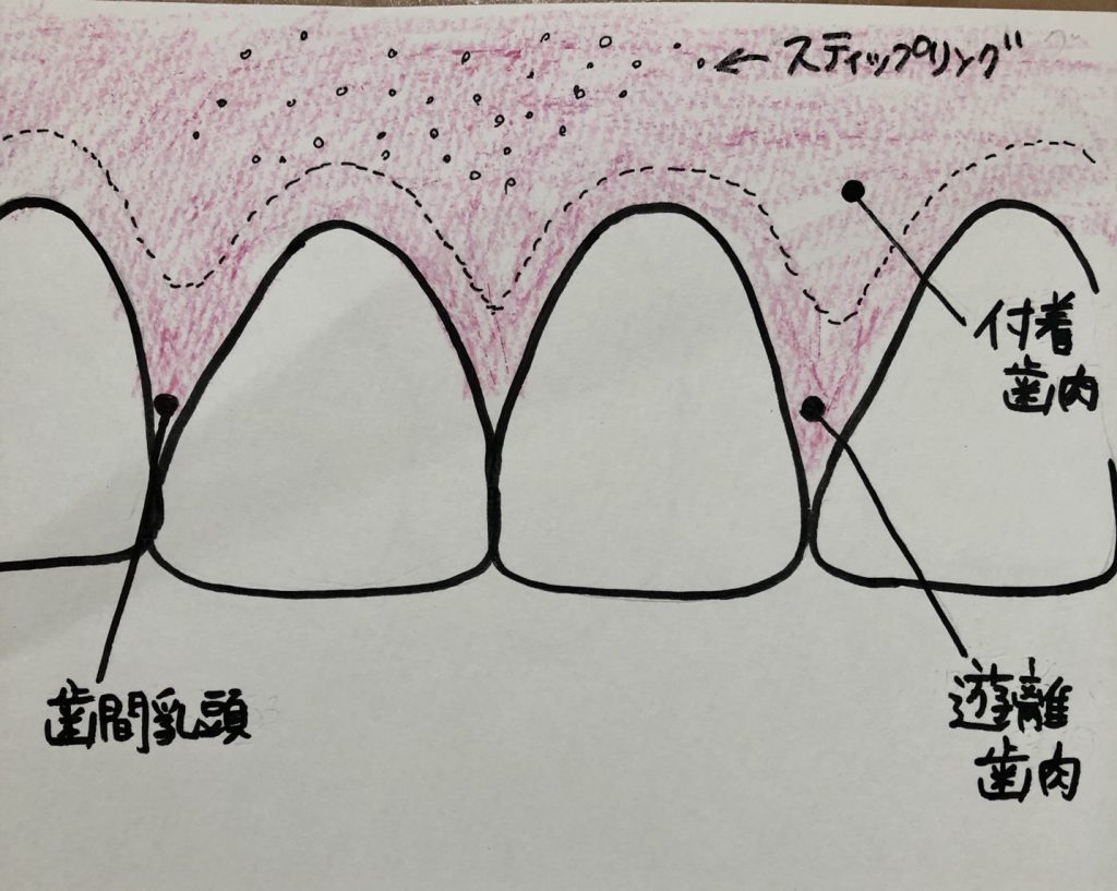 歯肉の構造