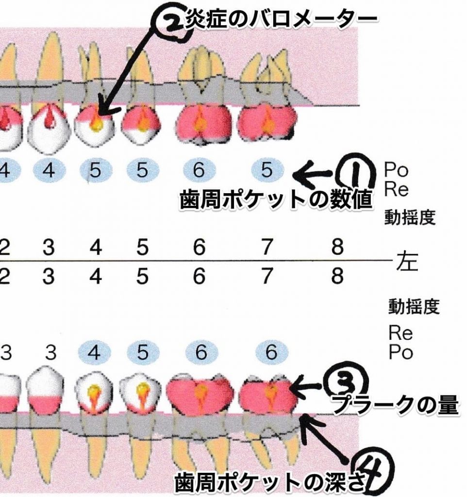 歯周診断書の解説