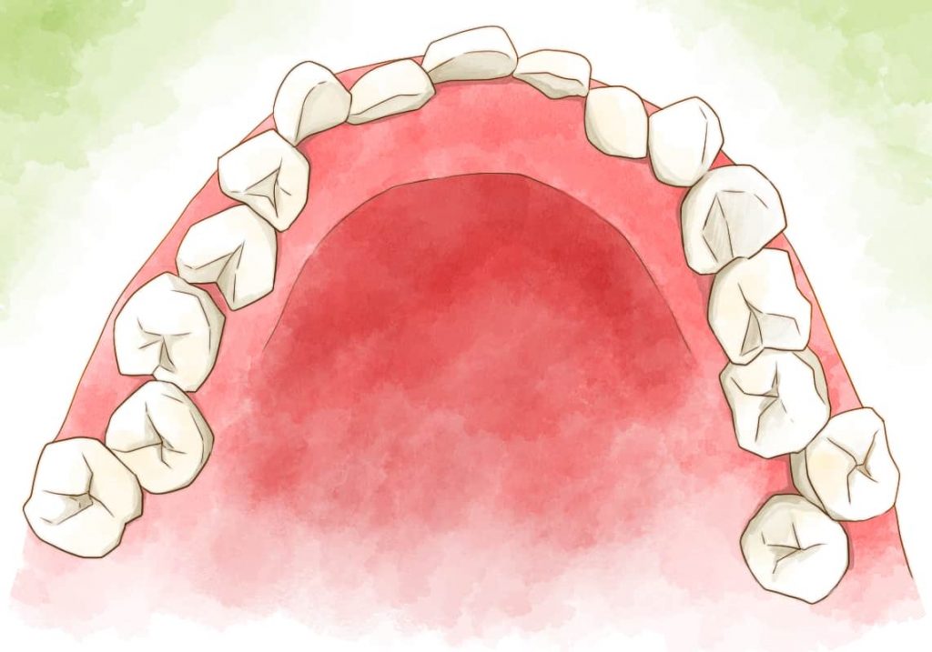 奥歯の歯並びが悪いイメージイラスト