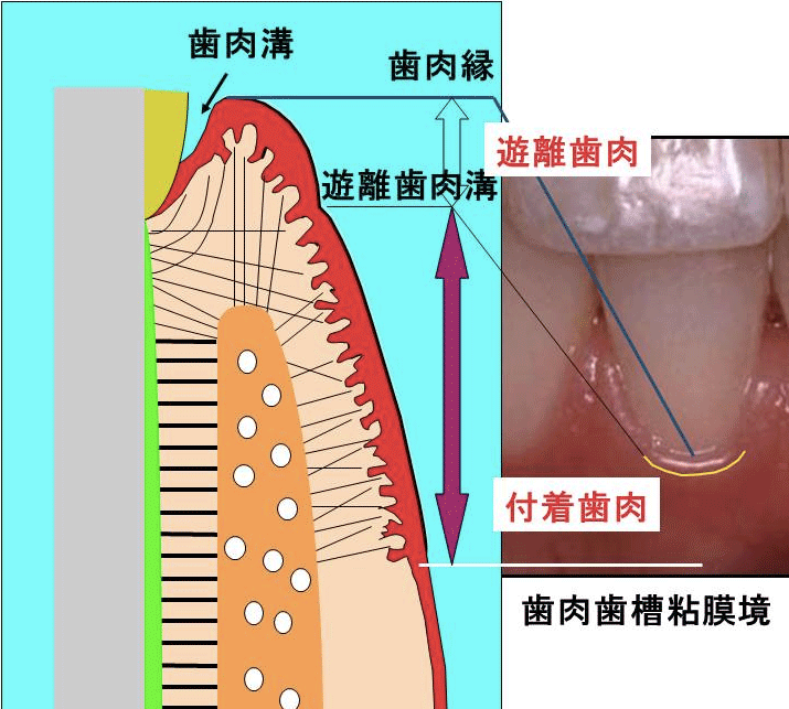 歯肉の断面(左)と表面の写真(右)